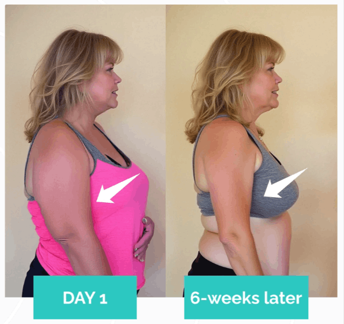 MyoGlow-Before-And-After